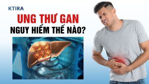 Ung thư gan là gì?