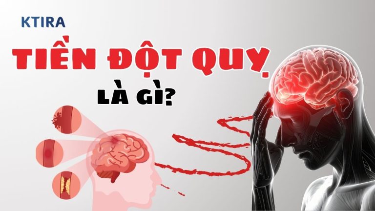 Tiền Đột Quỵ Là Gì? 4 Dấu Hiệu Cần Chú Ý!