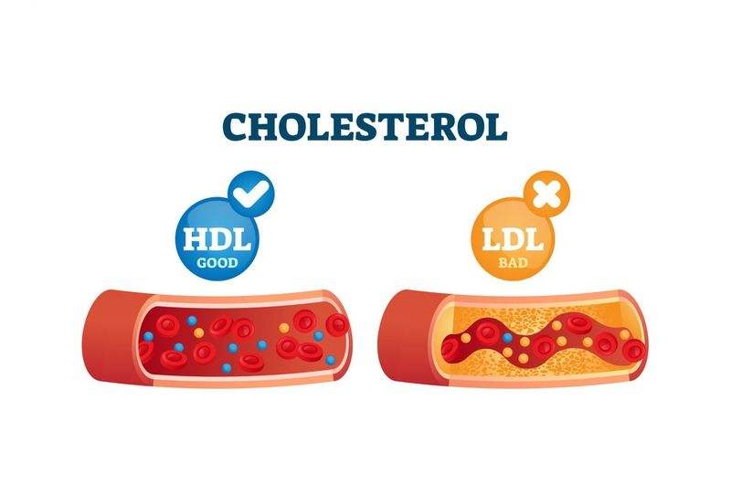 LDL cholesterol – "Cholesterol xấu" đáng lo ngại KTIRA 
