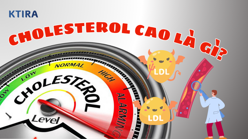 Cholesterol cao là gì? KTIRA