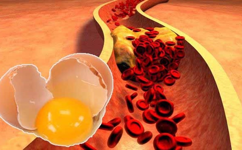 Mỡ máu cao có ăn được trứng không? KTIRA 