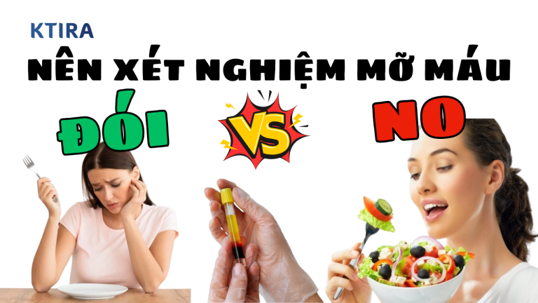 Nên xét nghiệm mỡ máu lúc đói hay no – Hướng dẫn giúp bạn có kết quả chính xác hơn