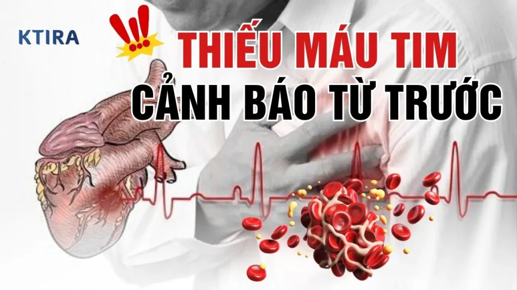Thiếu máu tim KTIRA