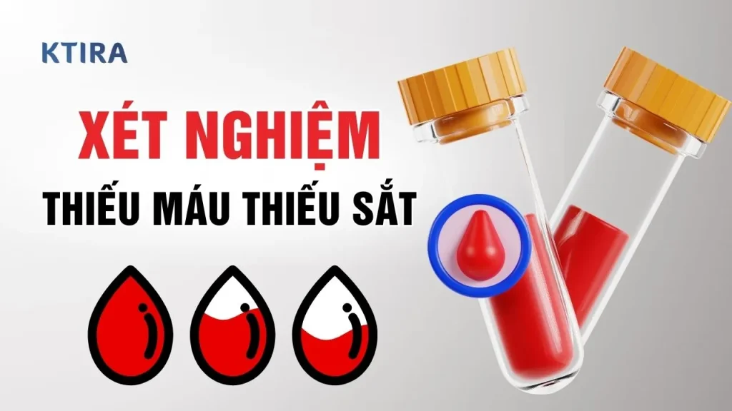 xét nghiệm thiếu máu thiếu sắt KTIRA