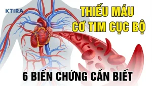 Thiếu máu cơ tim cục bộ KTIRA
