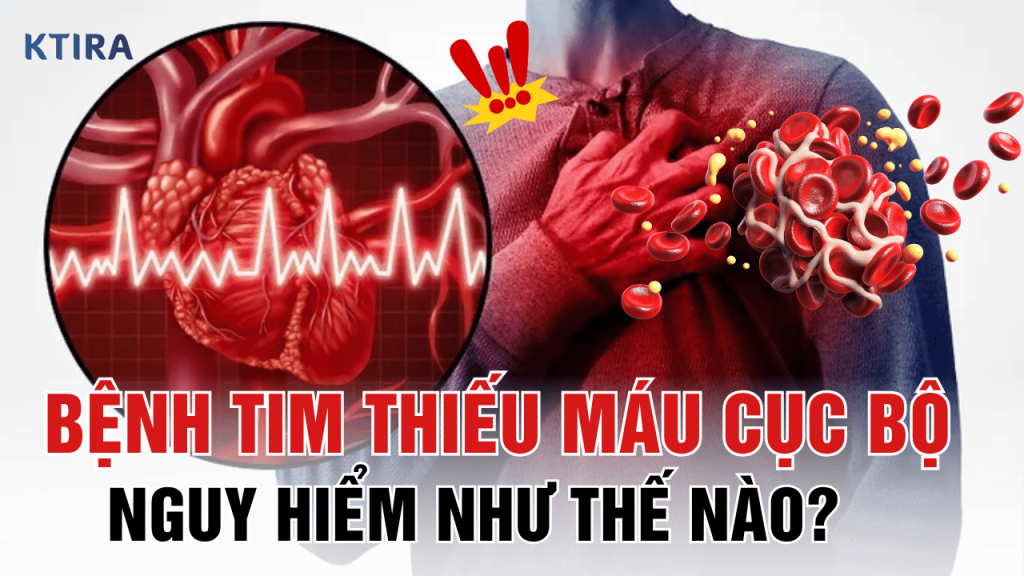 Bệnh Tim Thiếu Máu Cục Bộ KTIRA