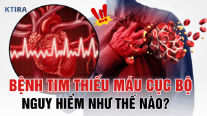 Bệnh Tim Thiếu Máu Cục Bộ KTIRA