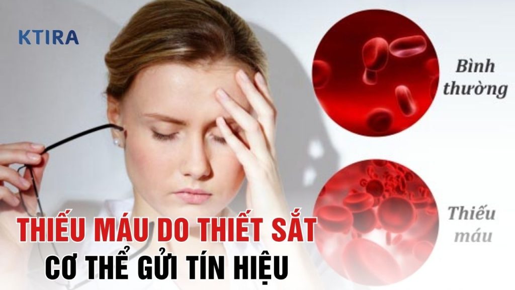 thiếu máu do thiếu sắt KTIRA