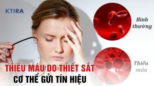 thiếu máu do thiếu sắt KTIRA