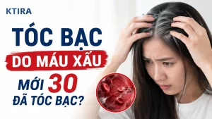 tóc bạc do máu xấu KTIRA
